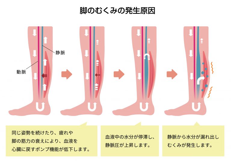足むくみを解消するツボ紹介 むくみの原因とふくらはぎの筋肉の関係って 京都四条烏丸のパーソナルトレーニングジムracine ラシーヌ
