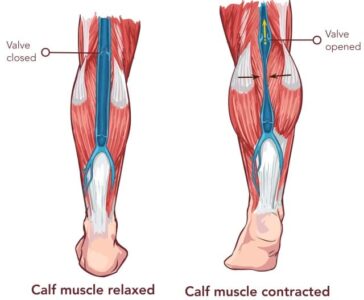 ふくらはぎの筋肉のポンプ作用